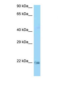 KRAS Antibody - KRAS antibody Western blot of Rat Lung lysate. Antibody concentration 1 ug/ml.  This image was taken for the unconjugated form of this product. Other forms have not been tested.