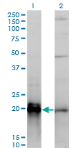 KRAS Antibody - Western Blot analysis of KRAS expression in transfected 293T cell line by KRAS monoclonal antibody (M01), clone 3B10-2F2.Lane 1: KRAS transfected lysate(21 KDa).Lane 2: Non-transfected lysate.