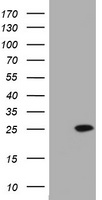 KRAS Antibody - HEK293T cells were transfected with the pCMV6-ENTRY control (Left lane) or pCMV6-ENTRY KRAS (Right lane) cDNA for 48 hrs and lysed. Equivalent amounts of cell lysates (5 ug per lane) were separated by SDS-PAGE and immunoblotted with anti-KRAS.