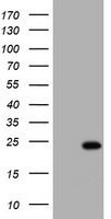 KRAS Antibody - HEK293T cells were transfected with the pCMV6-ENTRY control (Left lane) or pCMV6-ENTRY KRAS (Right lane) cDNA for 48 hrs and lysed. Equivalent amounts of cell lysates (5 ug per lane) were separated by SDS-PAGE and immunoblotted with anti-KRAS.