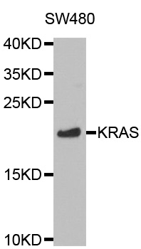KRAS Antibody - Western blot analysis of extracts of SW480 cell line, using KRAS antibody.