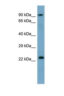 KRAS Antibody - KRAS antibody Western blot of Fetal Heart lysate. Antibody concentration 1 ug/ml. This image was taken for the unconjugated form of this product. Other forms have not been tested.