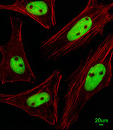 KRBA2 Antibody - Immunofluorescence of HeLa cells, using KRBA2 Antibody diluted 1:25. Alexa Fluor 488-conjugated goat anti-rabbit lgG at 1:400 dilution was used as the secondary antibody (green). Cytoplasmic actin was counterstained with Dylight Fluor 554 (red) conjugated Phalloidin (red).