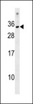 KRBOX1 Antibody - KRBOX1 Antibody western blot of NCI-H460 cell line lysates (35 ug/lane). The KRBOX1 antibody detected the KRBOX1 protein (arrow).