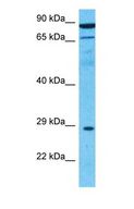 KRCC1 Antibody - Western blot of KRCC1 Antibody with human Liver Tumor lysate.  This image was taken for the unconjugated form of this product. Other forms have not been tested.