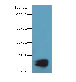 KRCC1 Antibody - Western blot. All lanes: KRCC1 antibody at 2 ug/ml+ Mouse kidney tissue Goat polyclonal to rabbit at 1:10000 dilution. Predicted band size: 23 kDa. Observed band size: 23 kDa.