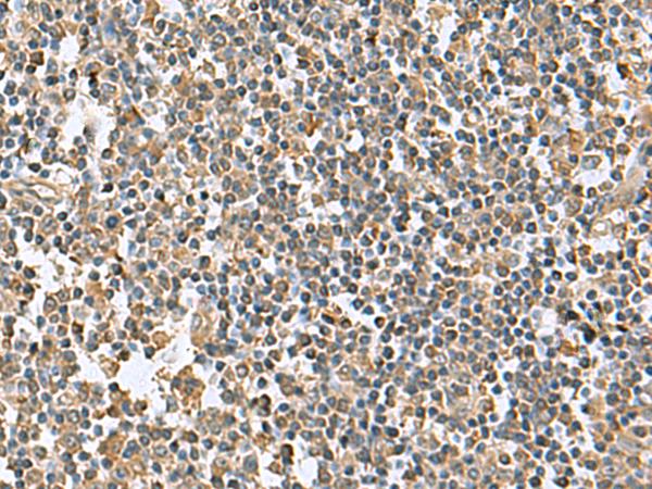 KRCC1 Antibody - Immunohistochemistry of paraffin-embedded Human tonsil tissue  using KRCC1 Polyclonal Antibody at dilution of 1:95(×200)