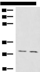 KRCC1 Antibody - Western blot analysis of Mouse brain tissue Mouse kidney tissue lysates  using KRCC1 Polyclonal Antibody at dilution of 1:1350