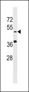 KREMEN1 / KREMEN-1 Antibody - Kremen (DKK5) Antibody (R21) western blot of HepG2 cell line lysates (35 ug/lane). The Kremen (DKK5) antibody detected the Kremen (DKK5) protein (arrow).