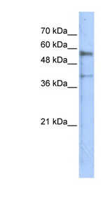 KREMEN1 / KREMEN-1 Antibody - KREMEN1 antibody Western blot of Transfected 293T cell lysate. This image was taken for the unconjugated form of this product. Other forms have not been tested.