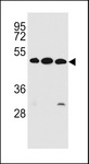 KREMEN2 Antibody - KREMEN2 Antibody western blot of ZR-75-1,K562,NCI-H460 cell line lysates (35 ug/lane). The KREMEN2 antibody detected the KREMEN2 protein (arrow).