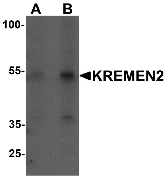 KREMEN2 Antibody - Western blot analysis of KREMEN2 in HeLa cell lysate with KREMEN2 antibody at (A) 1 and (B) 2 ug/ml.