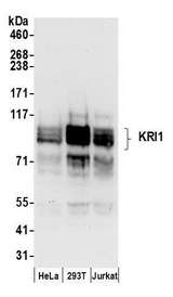 KRI1 Antibody - Detection of human KRI1 by western blot. Samples: Whole cell lysate (50 µg) from HeLa, HEK293T, and Jurkat cells prepared using NETN lysis buffer. Antibodies: Affinity purified rabbit anti-KRI1 antibody used for WB at 0.1 µg/ml. Detection: Chemiluminescence with an exposure time of 30 seconds.