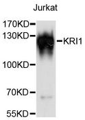KRI1 Antibody - Western blot analysis of extracts of Jurkat cells, using KRI1 antibody at 1:3000 dilution. The secondary antibody used was an HRP Goat Anti-Rabbit IgG (H+L) at 1:10000 dilution. Lysates were loaded 25ug per lane and 3% nonfat dry milk in TBST was used for blocking. An ECL Kit was used for detection and the exposure time was 1s.