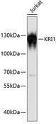 KRI1 Antibody - Western blot analysis of extracts of Jurkat cells using KRI1 Polyclonal Antibody at dilution of 1:3000.