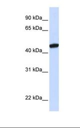 KRR1 Antibody - Fetal brain lysate. Antibody concentration: 1.0 ug/ml. Gel concentration: 12%.  This image was taken for the unconjugated form of this product. Other forms have not been tested.