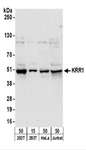 KRR1 Antibody - Detection of Human KRR1 by Western Blot. Samples: Whole cell lysate from 293T (15 and 50 ug), HeLa (50 ug), and Jurkat (50 ug) cells. Antibodies: Affinity purified rabbit anti-KRR1 antibody used for WB at 0.1 ug/ml. Detection: Chemiluminescence with an exposure time of 30 seconds.