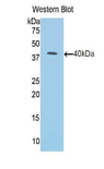 KRT1 / CK1 / Cytokeratin 1 Antibody - Western blot of recombinant KRT1 / CK1 / Cytokeratin 1.  This image was taken for the unconjugated form of this product. Other forms have not been tested.