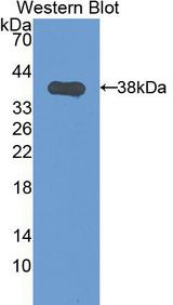 KRT1 / CK1 / Cytokeratin 1 Antibody - Western Blot; Sample: Recombinant protein.