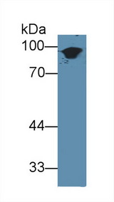 KRT1 / CK1 / Cytokeratin 1 Antibody - Western Blot; Sample: Mouse Skin lysate; Primary Ab: 3µg/ml Rabbit Anti-Mouse KRT1 Antibody Second Ab: 0.2µg/mL HRP-Linked Caprine Anti-Rabbit IgG Polyclonal Antibody