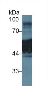 KRT1 / CK1 / Cytokeratin 1 Antibody - Western Blot; Sample: Human A431 cell lysate; Primary Ab: 1µg/ml Rabbit Anti-Rat KRT1 Antibody Second Ab: 0.2µg/mL HRP-Linked Caprine Anti-Rabbit IgG Polyclonal Antibody