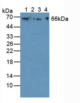 KRT1 / CK1 / Cytokeratin 1 Antibody - Western Blot; Sample: Lane1: Human A375 Cells; Lane2: Human H460 Cells; Lane3: Human Hela Cells; Lane4: Mouse Pancreas Tissue.