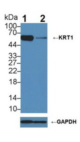 KRT1 / CK1 / Cytokeratin 1 Antibody - Knockout Varification: Lane 1: Wild-type A431 cell lysate; Lane 2: KRT1 knockout A431 cell lysate; Predicted MW: 66kDa ; Observed MW: 66kDa; Primary Ab: 3µg/ml Rabbit Anti-Human KRT1 Antibody; Second Ab: 0.2µg/mL HRP-Linked Caprine Anti-Rabbit IgG Polyclonal Antibody;