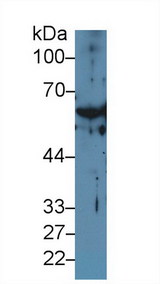 KRT1 / CK1 / Cytokeratin 1 Antibody - Western Blot; Sample: Rat Serum; Primary Ab: 1µg/ml Rabbit Anti-Rat KRT1 Antibody Second Ab: 0.2µg/mL HRP-Linked Caprine Anti-Rabbit IgG Polyclonal Antibody