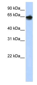 KRT1 / CK1 / Cytokeratin 1 Antibody - Western blot of 293T cell lysate.  This image was taken for the unconjugated form of this product. Other forms have not been tested.