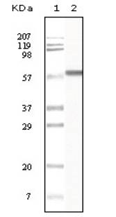 KRT1 / CK1 / Cytokeratin 1 Antibody - Western blot analysis of truncated CK1 recombinant protein