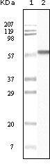 KRT1 / CK1 / Cytokeratin 1 Antibody - CK1 alpha Antibody in Western Blot (WB)