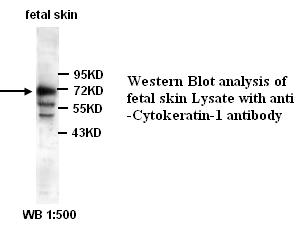 KRT1 / CK1 / Cytokeratin 1 Antibody