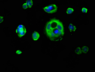 KRT1 / CK1 / Cytokeratin 1 Antibody - Immunofluorescence staining of MCF-7 cells at a dilution of 1:133, counter-stained with DAPI. The cells were fixed in 4% formaldehyde, permeabilized using 0.2% Triton X-100 and blocked in 10% normal Goat Serum. The cells were then incubated with the antibody overnight at 4 °C.The secondary antibody was Alexa Fluor 488-congugated AffiniPure Goat Anti-Rabbit IgG (H+L) .