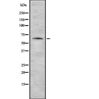 KRT1 / CK1 / Cytokeratin 1 Antibody - Western blot analysis of K2C1 expression in HEK293 cells. The lane on the left is treated with the antigen-specific peptide.