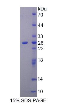 KRT1 / CK1 / Cytokeratin 1 Protein - Recombinant Keratin 1 By SDS-PAGE
