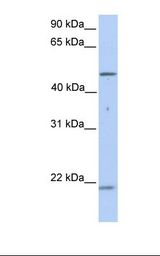KRT10 / CK10 / Cytokeratin 10 Antibody - 721_B cell lysate. Antibody concentration: 1.0 ug/ml. Gel concentration: 12%.  This image was taken for the unconjugated form of this product. Other forms have not been tested.