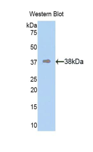 KRT10 / CK10 / Cytokeratin 10 Antibody - Western blot of recombinant KRT10 / CK10 / Cytokeratin 10.  This image was taken for the unconjugated form of this product. Other forms have not been tested.