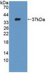 KRT10 / CK10 / Cytokeratin 10 Antibody - Western Blot; Sample: Recombinant KRT10, Human.