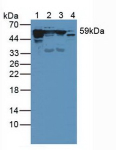 KRT10 / CK10 / Cytokeratin 10 Antibody - Western Blot; Sample: Lane1: Rat Skin Tissue; Lane2: Rat Brain Tissue; Lane3: Mouse Brain Tissue; Lane4: Mouse Skin Tissue.