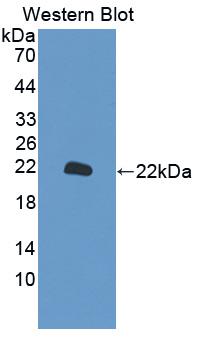 KRT10 / CK10 / Cytokeratin 10 Antibody - Western Blot; Sample: Recombinant protein.