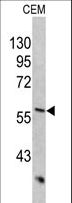 KRT10 / CK10 / Cytokeratin 10 Antibody - Western blot of KRT10 antibody in CEM cell line lysates (35 ug/lane). KRT10 (arrow) was detected using the purified antibody.