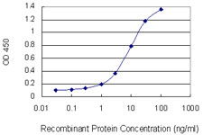 KRT10 / CK10 / Cytokeratin 10 Antibody - Detection limit for recombinant GST tagged KRT10 is 0.3 ng/ml as a capture antibody.