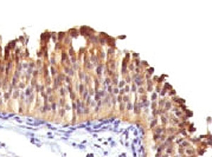 KRT10 / CK10 / Cytokeratin 10 Antibody -  This image was taken for the unmodified form of this product. Other forms have not been tested.