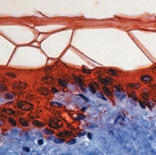 KRT10 / CK10 / Cytokeratin 10 Antibody - Formalin-fixed, paraffin-embedded human skin stained with peroxidase-conjugate and AEC chromogen. Note cytoplasmic staining of epidermal region. This image was taken for the unmodified form of this product. Other forms have not been tested.