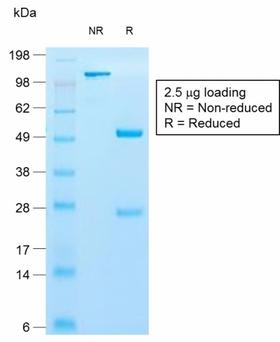 KRT10 / CK10 / Cytokeratin 10 Antibody - SDS-PAGE Analysis of Purified Cytokeratin 10 Rabbit Recombinant Monoclonal Antibody (KRT10/1990R). Confirmation of Purity and Integrity of Antibody.