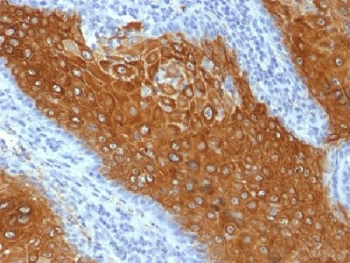 KRT10 / CK10 / Cytokeratin 10 Antibody - IHC testing of FFPE human skin with Keratin 10 antibody (clone KRT10/844). Required HIER: boil tissue sections in 10mM citrate buffer, pH 6.0, for 10-20 min.