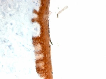 KRT10 / CK10 / Cytokeratin 10 Antibody - Formalin-fixed, paraffin-embedded human skin stained with Keratin 10 antibody (KRT10/844).  This image was taken for the unmodified form of this product. Other forms have not been tested.