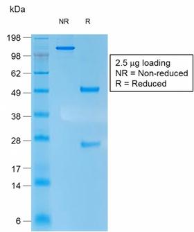 KRT10 / CK10 / Cytokeratin 10 Antibody - SDS-PAGE Analysis of Purified Cytokeratin 10 Mouse Recombinant Monoclonal Antibody (rKRT10/1275). Confirmation of Purity and Integrity of Antibody.