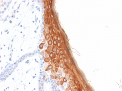 KRT10 / CK10 / Cytokeratin 10 Antibody - Formalin-fixed, paraffin-embedded human Skin stained with Cytokeratin 10 Mouse Recombinant Monoclonal Antibody (rKRT10/844).