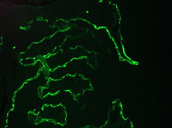 KRT10 / CK10 / Cytokeratin 10 Antibody - Immunofluorescence staining of a 7 days old zebrafish embryo